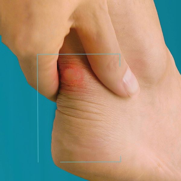 COMPEED plastry na pęcherze odciski mix 5 szt x2 zdjęcie 6