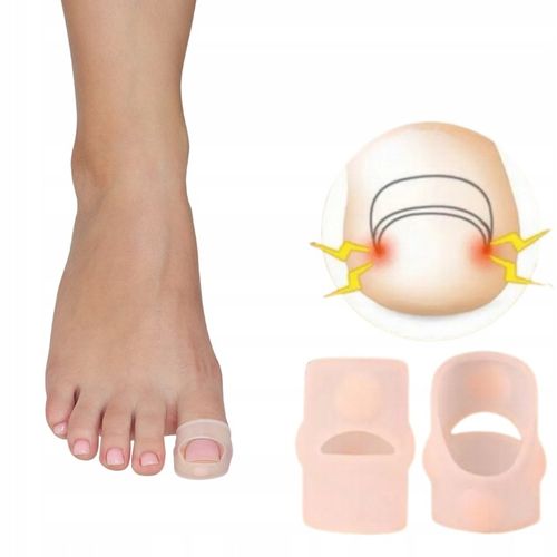 Nakładki silikonowe na wrastający paznokieć N75 na Arena.pl