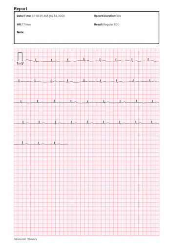 Ciśnieniomierz naramienny z funkcją badania EKG BP2 IOS Android na Arena.pl