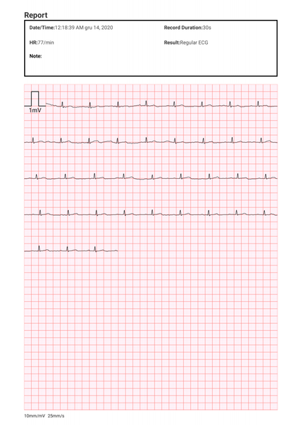 Ciśnieniomierz naramienny z funkcją badania EKG BP2 IOS Android zdjęcie 17