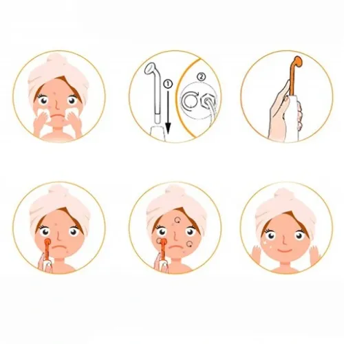 Derma wand DARSONVAL do zabiegów na TWARZY WŁOSY 4 elektrody NAJMOCNIEJSZY na Arena.pl