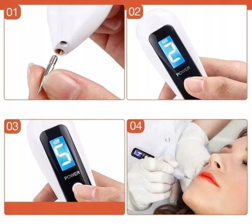 ZESTAW DO USUWANIA BRODAWEK ZMIAN SKÓRNYCH TATUAŻY BLIZN PLAZMA PEN LASER na Arena.pl