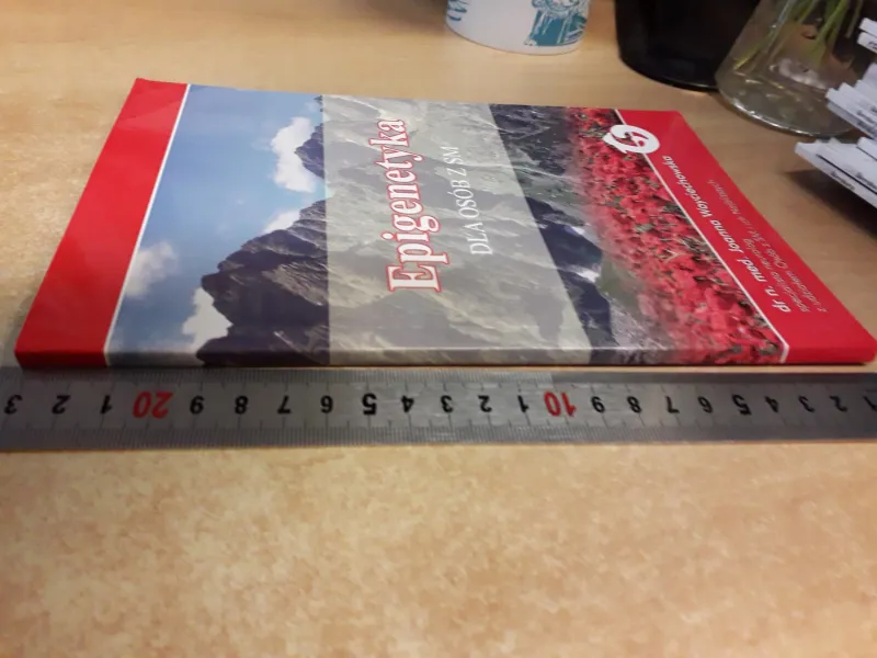 EPIGENETYKA DLA OSÓB Z SM zdjęcie 3