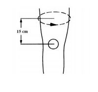 STABILIZATOR KOLANA ORTEZA OPASKA NA KOLANO ŚCIĄGACZ