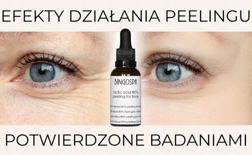 BARDZO MOCNY PEELING KWASOWY DO TWARZY 30 ml BINGOSPA na Arena.pl