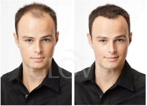 Włókna Mikrowłókna w Sprayu Wodoodporne Zagęszczanie Włosów Naturalny na Arena.pl