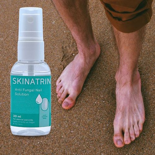 SKINATRIN 30ml – SILNY SPRAY NA GRZBICE STÓP I PAZNOKCI na Arena.pl