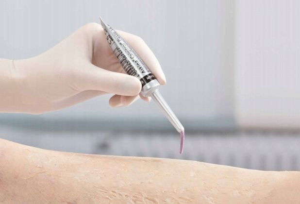 ASKINA CALGITROL PASTA NA RANY BBRAUN 15G SREBRO zdjęcie 2