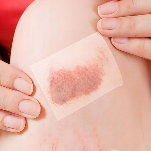 Plastry hydrokoloidowe ochronne szybkie gojenie odcisków pęcherzy na Arena.pl