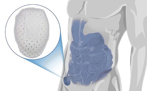 MEDYCZNY PAS PRZEPUKLINOWY PACHWINOWY DO LEWA I PRAWA STRONY 75-92 cm BIAŁY na Arena.pl