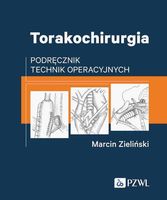 TORAKOCHIRURGIA MARCIN ZIELIŃSKI