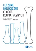 Leczenie biologiczne chorób reumatycznych
