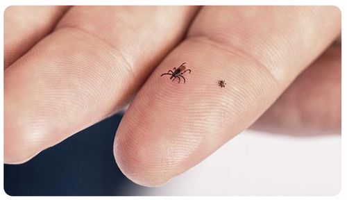 aspivenin miniaturowa pompka ssąca na Arena.pl