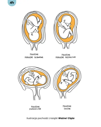 Ważne! Ciąża na Arena.pl