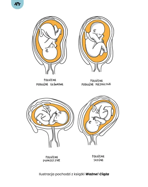 Ważne! Ciąża zdjęcie 4