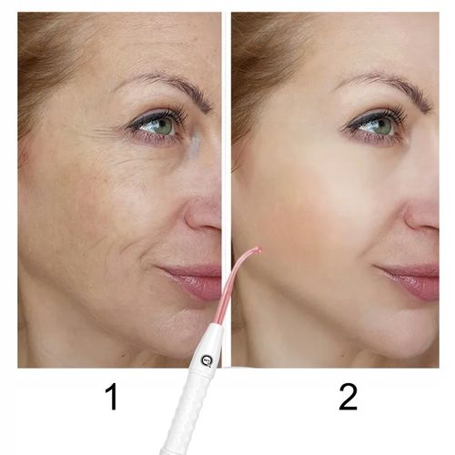 DARSONVAL QSKY DERMA WAND 4w1 PRO DO PIELĘGNACJI TWARZY ZMARSZCZEK I WŁOSÓW na Arena.pl