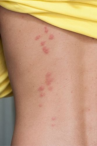 Pluskwa Stop MAX 300 ml +RABAT na Arena.pl