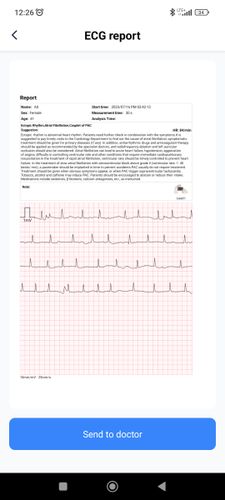 Przenośny Aparat EKG Pulsebit z kablem odprowadzeniowym Arytmia na Arena.pl
