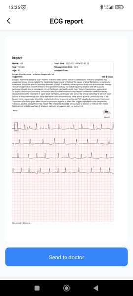 Przenośny Aparat EKG Pulsebit z kablem odprowadzeniowym Arytmia zdjęcie 3