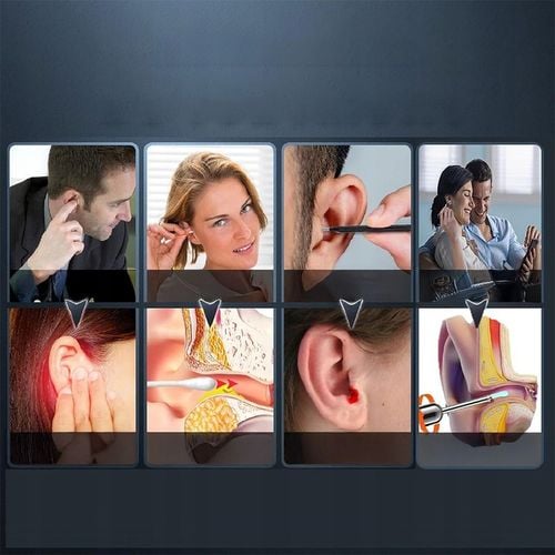 SMART OTOSKOP Z KAMERKĄ WIFI DO CZYSZCZENIA USZU NARZĘDZIA ZESTAW ENDOSKOP na Arena.pl