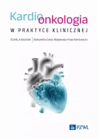Kardioonkologia w praktyce klinicznej