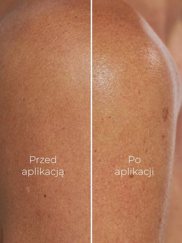 Balsam do ciała nawilżający krem do skóry suchej Swederm Gel Trap 250 ml na Arena.pl