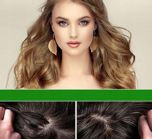 OLEJEK BATANA DO POROSTU WŁOSÓW DLA KOBIET I MĘŻCZYZN PREMIUM NA ŁYSIENIE na Arena.pl