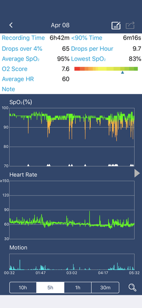 Pulsoksymetr monitor snu i oddechu z alarmem, aplikacją, wykresami - SleepU zdjęcie 5