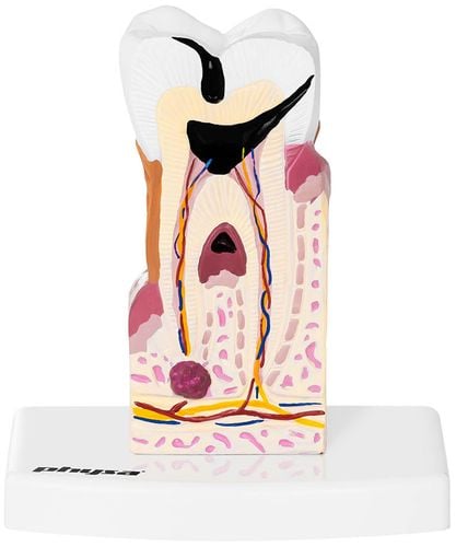 Chory ząb - model anatomiczny Physa PHY-TM-1 na Arena.pl