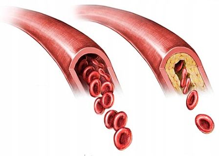3x CHOLESTEROL FORTE 135kaps BERGAMOTA PROTON LABS na Arena.pl
