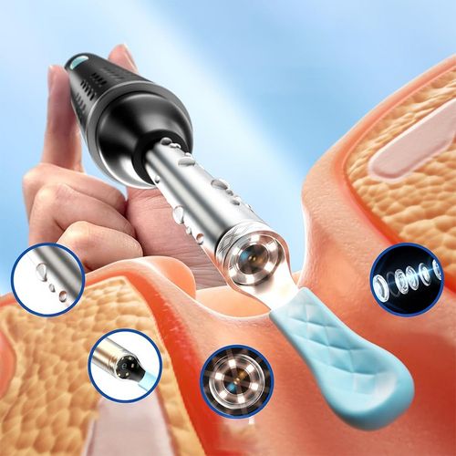 SMART OTOSKOP Z KAMERKĄ WIFI DO CZYSZCZENIA USZU NARZĘDZIA ZESTAW ENDOSKOP na Arena.pl