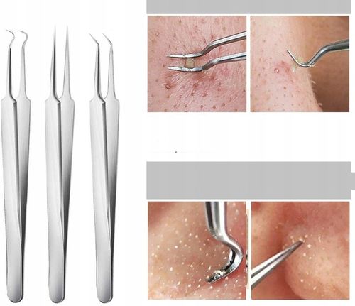 10× łyżeczki UNNY pęseta igła do usuwania zaskórników wągrów pryszczy na Arena.pl