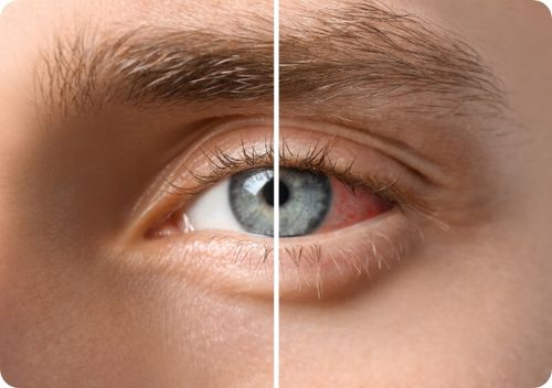 Hialeye Duo krople do oczu + Potazek potas magnez na Arena.pl