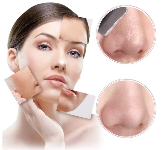 PEELING KAWITACYJNY BEZPRZEWODOWY URZĄDZENIE PILING DO TWARZY 5W1 BIAŁ zdjęcie 10