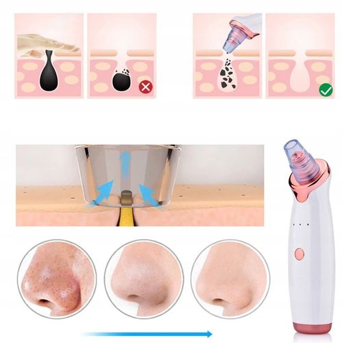 ODKURZACZ WĄGRÓW 12w1 Mikrodermabrazja + Masażer + na Arena.pl