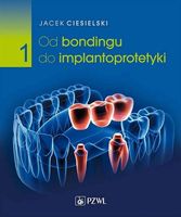 OD BONDINGU DO IMPLANTOPROTETYKI CZĘŚĆ 1 JACEK CIESIELSKI