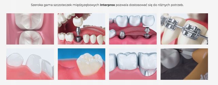 INTERPROX PLUS 2G DENTAID 1,7 CONIC 6 szt. zdjęcie 3