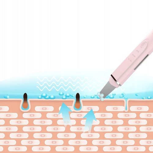 InFace ULTRADŹWIĘKOWY PEELING KAWITACYJNY DO TAWRZY BEZBOLESNY zabieg na Arena.pl