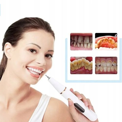 SKALER ULTRADŹWIĘKOWY DO ZĘBÓW DENTYSTYCZNY SMART USUWANIE KAMIENIA na Arena.pl