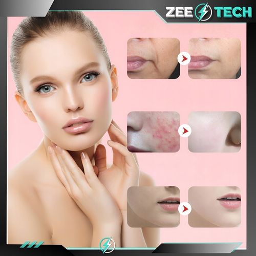 MEZOTERAPIA BEZIGŁOWA 7w1 MASAŻER DO TWARZY ELEKTRYCZNY EMS LIFTING na Arena.pl