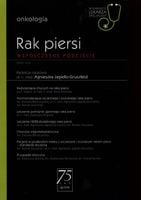Rak piersi Agnieszka Jagiełło-Gruszfeld
