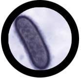 Dżuma (Yersinia pestis) na Arena.pl