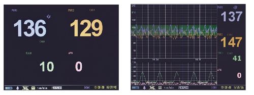 Kardiotokograf Aparat KTG Monitor Płodu JPD-300Pb + sondy na Arena.pl