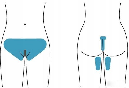 Pasta cukrowa do depilacji miejsc intymnych bikini pupy dla mężczyzn kobiet na Arena.pl