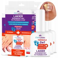 LAKIER PREPARAT NA GRZYBICĘ PAZNOKCI STÓP PRZECIWGRZYBICZNY OCHRONA 3x