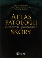 Atlas patologii złośliwych nowotworów skóry Andrzej Kaszuba, Krzysztof W.…