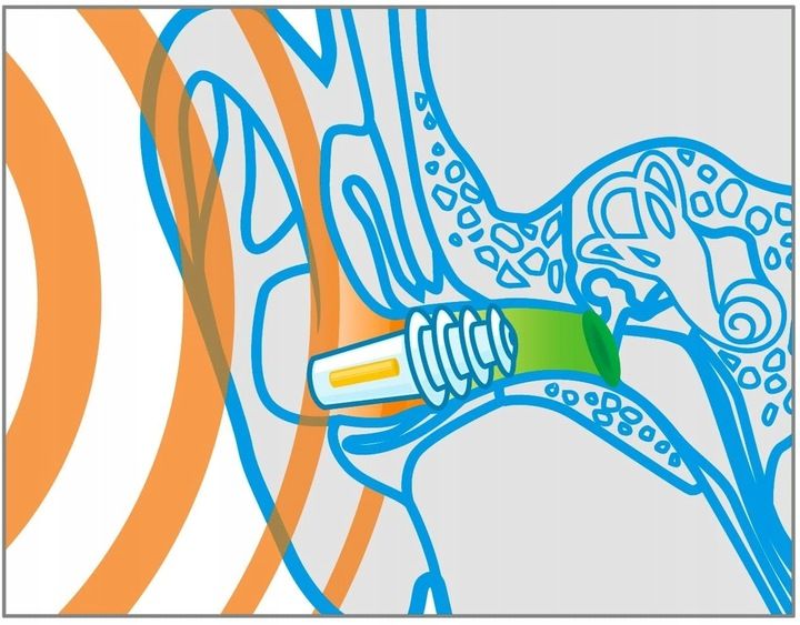STOPERY ZATYCZKI DO USZU SANOHRA FLY DO SAMOLOTU zdjęcie 4