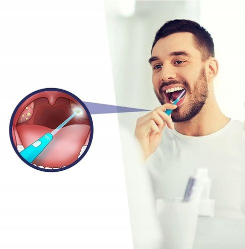 Zestaw LED do usuwania kamieni migdałkowych GRATIS na Arena.pl