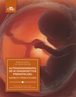 Ultrasonografia 3D w diagnostyce prenatalnej