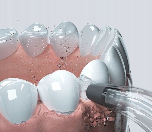 Bezprzewodowy Irygator Dentystyczny Oclean W1 na Arena.pl